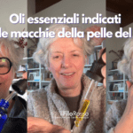 Oli essenziali indicati per le macchie della pelle del viso