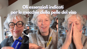 Oli essenziali indicati per le macchie della pelle del viso